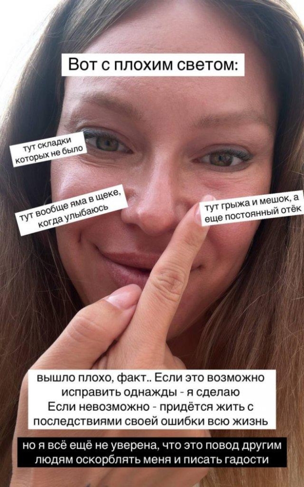 Певица Рита Дакота изуродовала себя после пластической операции