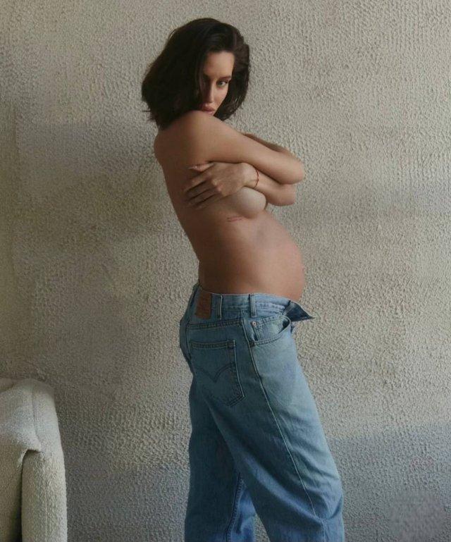 Девушка Тимати показала сделанную грудь и губы