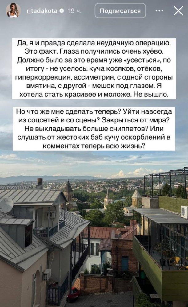 Певица Рита Дакота изуродовала себя после пластической операции