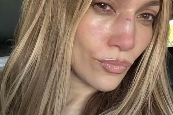 Дженнифер Лопес показала, как замазывает разбитый нос