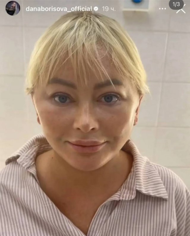 Дана Борисова сделала очередную пластику - и эти фото введут вас в ступор (3 фото + видео)