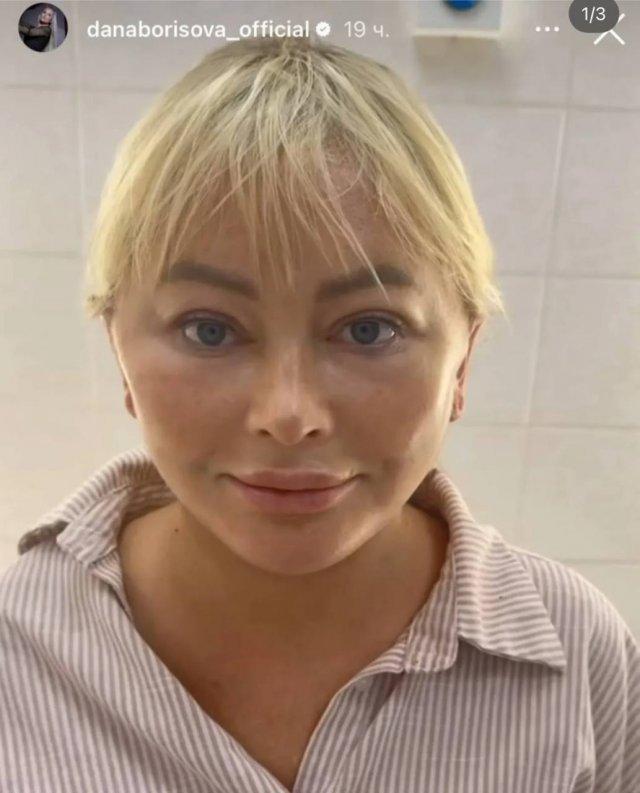 Дана Борисова сделала очередную пластику - и эти фото введут вас в ступор