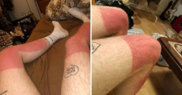 Смешные примеры неудачного загара