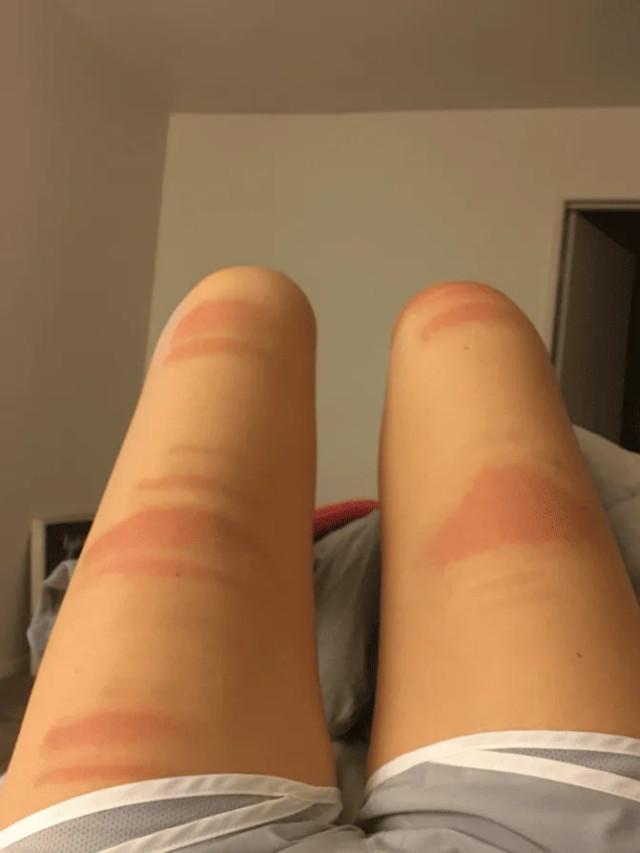Смешные примеры неудачного загара