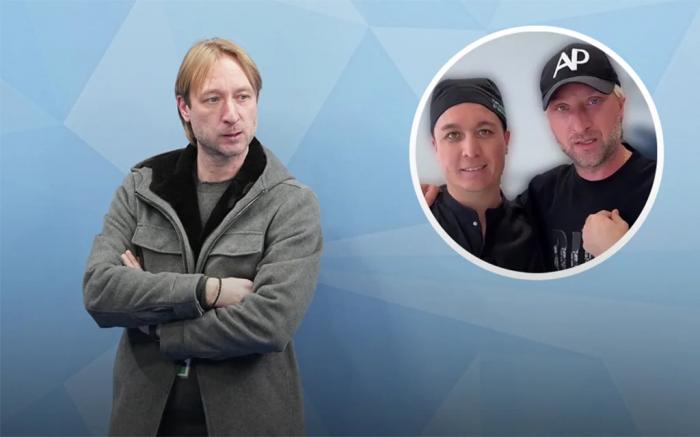 Евгений Плющенко показал результаты пластической операции