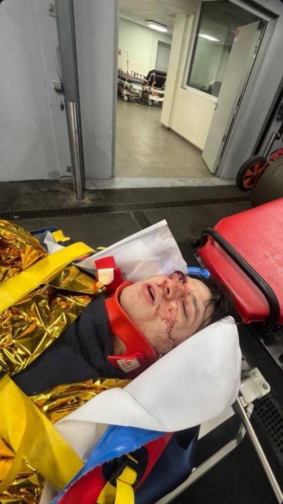 Участник "голой вечеринки" Васио выпал с третьего этажа в Париже - жутки кадры рэпера Участник "голой вечеринки" Васио выпал с третьего этажа в Париже - жутки кадры рэпера