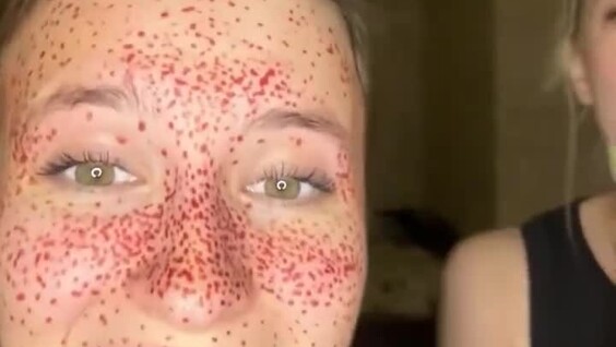 
        В&nbsp;погоне за&nbsp;естественной красотой: девушки нарисовали веснушки и&nbsp;пожалели    