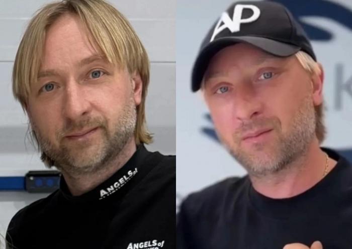 Евгений Плющенко показал результаты пластической операции