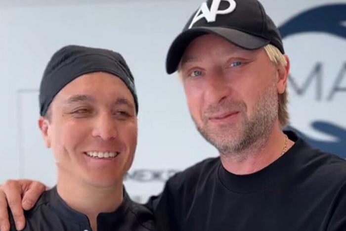 Евгений Плющенко показал результаты пластической операции