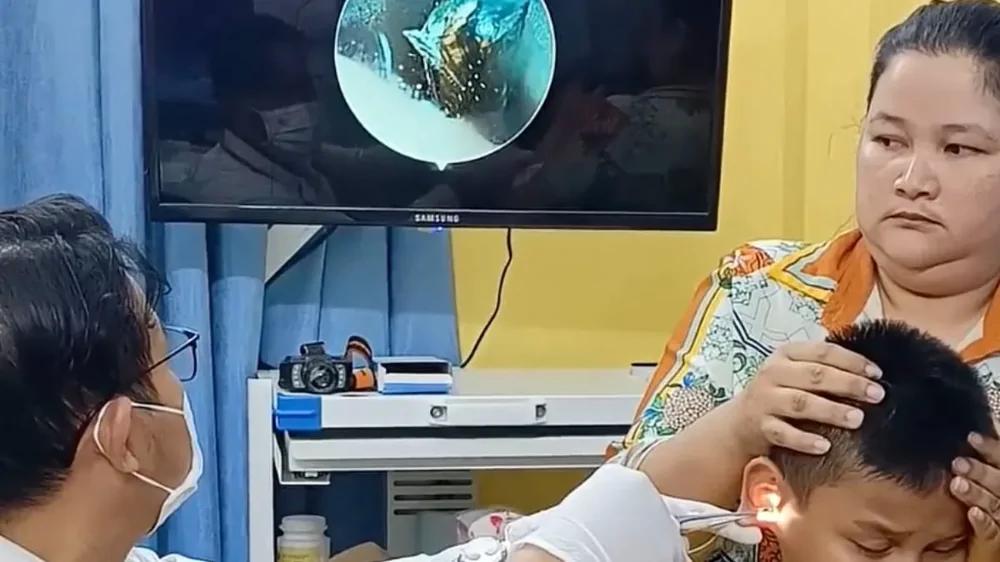 В Камбодже у подростка в ухе обнаружили живого таракана
В Камбодже у подростка в ухе обнаружили живого таракана