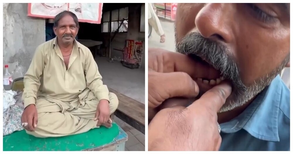 
        Шокирующая стоматологическая практика в&nbsp;Пакистане    