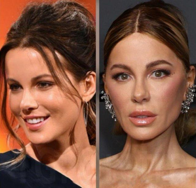 В Сети активно обсуждают новый образ Кейт Бекинсейл после её недавнего появления в вечернем шоу