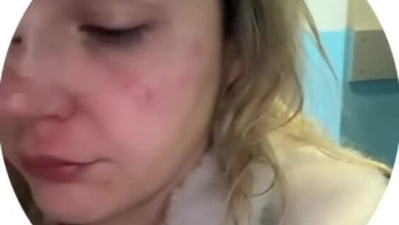 
        Девушка пожалела, что&nbsp;поехала тусоваться со&nbsp;вспыльчивыми парнями    