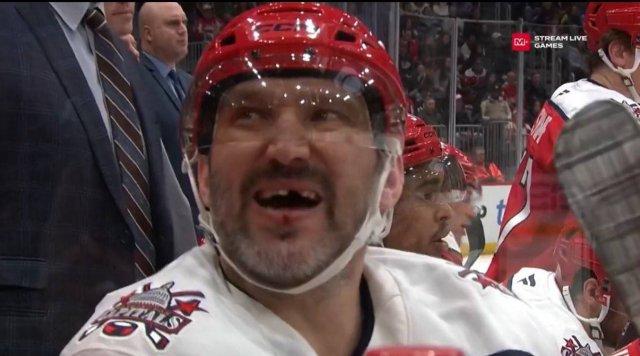 Александру Овечкину выбили зуб во время игры Александру Овечкину выбили зуб во время игры