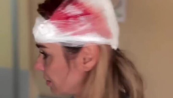 
        Под&nbsp;Калининградом женщина разбила голову во&nbsp;время катания на&nbsp;ватрушке    