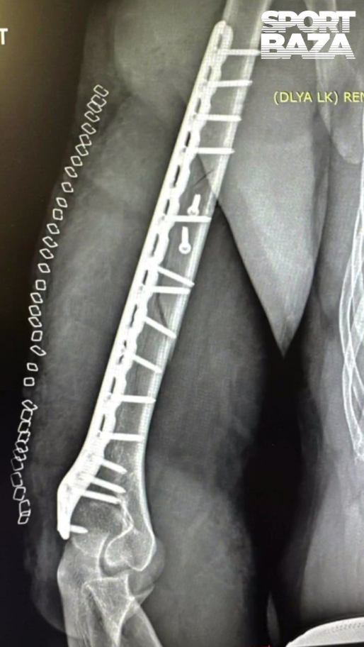 Аккуратней на спортплощадке (2 фото + видео)