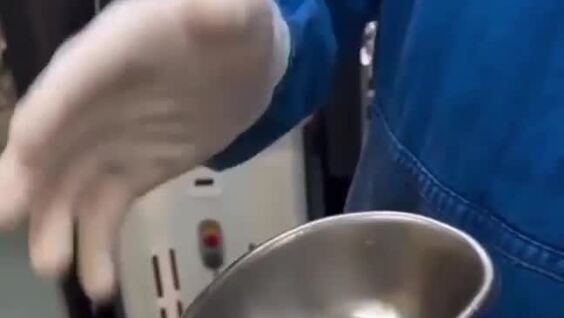 
        Медики извлекли десятки камней из&nbsp;мочевого пузыря любителя сладкой газировки    