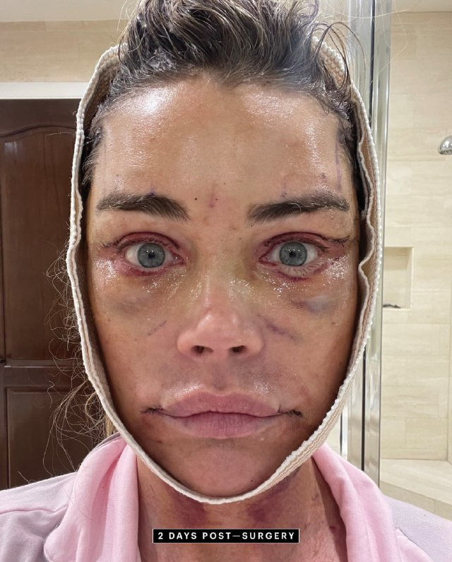 Дениз Ричардс в 55 лет сделала полную подтяжку лица и показала впечатляющий результат