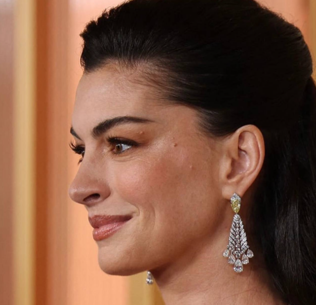 Фотографии знаменитостей с премии &laquo;Оскар&raquo; без ретуши