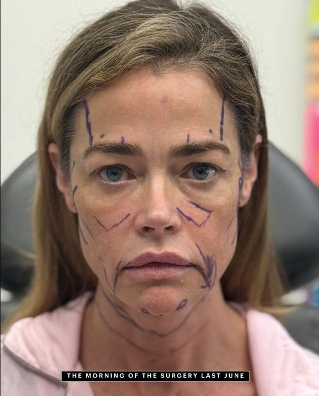 Дениз Ричардс в 55 лет сделала полную подтяжку лица и показала впечатляющий результат