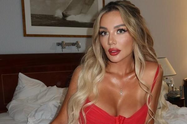 Анна Седокова ответила всем, кто критикует ее внешность