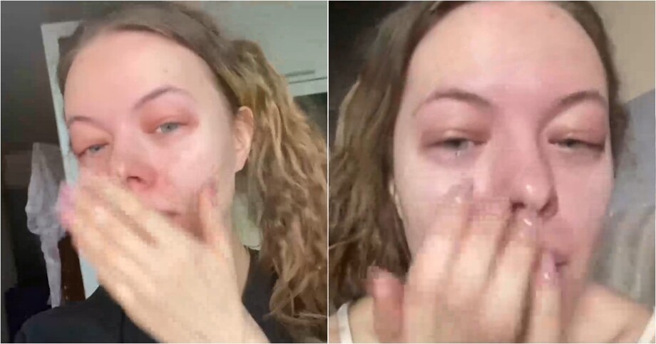 
        Жительница Воронежа чуть не&nbsp;задохнулась после выпитого протеина    